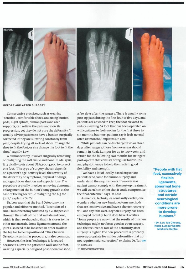Dr Low - Global Health and Travel - Undergoing a Bunionectomy - Pg 2