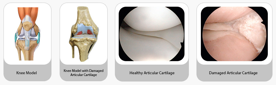 articular_cartilage