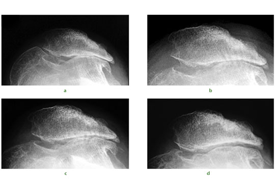 fig1