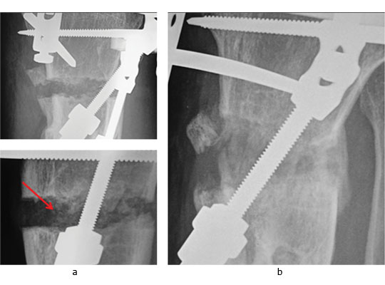 fig4