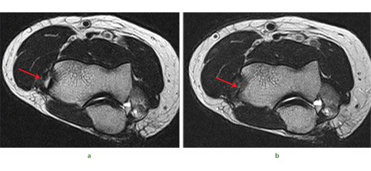 fig6